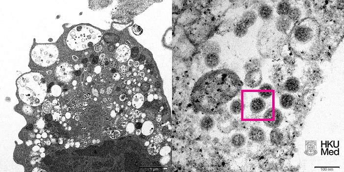 İlk Görüntü Geldi: Omicron Varyantının Fotoğrafı Yayınlandı