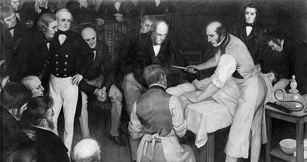 1. Dr. Robert Liston, 19. yüzyılın en hızlı cerrahı olarak biliniyor. Hatta, bir operasyonunda hastasının bacağını ampute etmesi iki buçuk dakika sürdü.