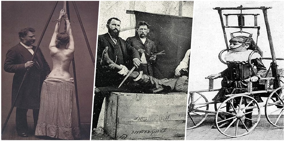 Londra Bilim Merkezi Müzesi'nde Sergilenen Tıp Tarihinin Korkutucu 20 Fotoğrafı