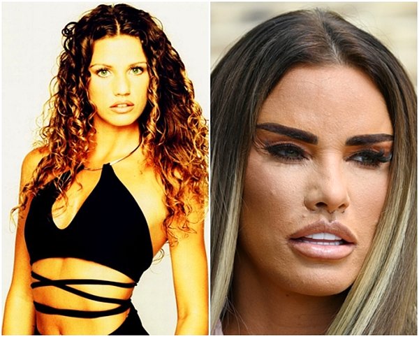 8. 34 yaşındaki model Katie Price oldukça ağır estetik operasyonlar geçirmiş.