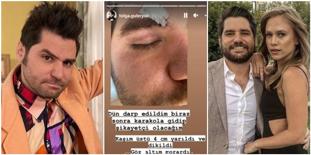 Gittiği Mekanda Saldırıya Uğrayan 80'ler Dizisinin Şahin'i Ceyhun Fersoy Hastanelik Oldu!