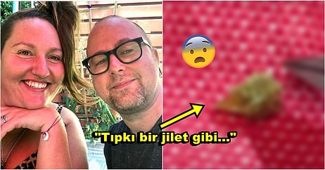 Tuvalette Çıkardığı Böbrek Taşı ile İnsanı Yeni Fobi Sahibi Yapan Adamın Yaşadığı Acı Dolu Deneyimi