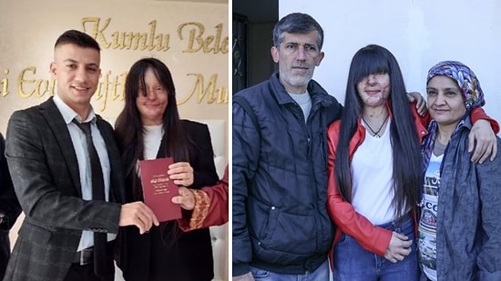 Berfin Özek'in Babası Konuştu: 'Günlerce Hastanede Yattı, Nasıl Yapar Bunu?'