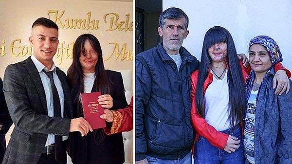 10. 2 yıl önce asitli saldırısına uğradığı eski erkek arkadaşı ile evlenen Berfin Özek'in babası Yaşar Özek, evliliğe tepki gösterirken, 'Sosyal medyadan öğrendim' dedi.