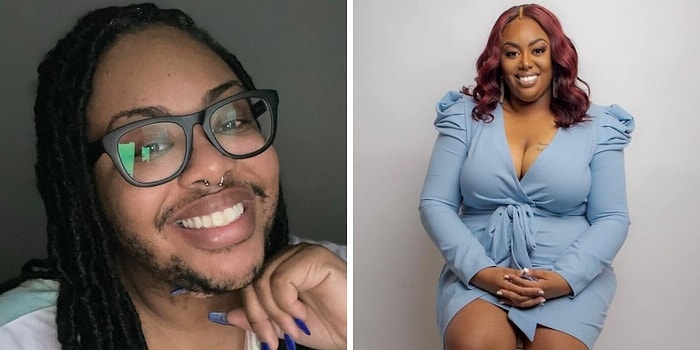 Девушка c гирсутизмом поделилась своим опытом в надежде повысить осведомленность об этом состоянии