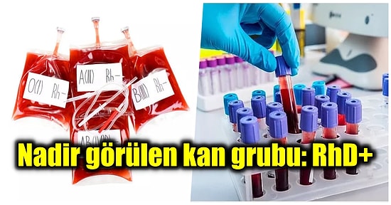 Neden Tüm İnsanların Kan Grubu Aynı Değil?