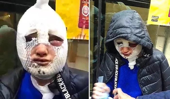 Hatay'da Eski Sözlüsüne Cinsel Saldırıda Bulunan ve Vücuduna Kızgın Yağ Döken Resul Erkmen Tutuklandı