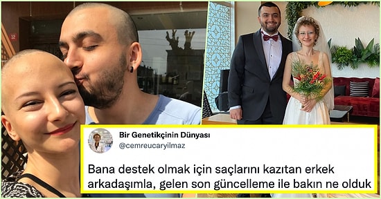 Kanser Tedavisi Gören Sevgilisi İçin Saçlarını Kazıtan Adam, Size 'Aşk Böyle Bir Şey mi?' Dedirtecek