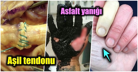 ‘Doktorlar’ Dizisine Taş Çıkaracak Birbirinden İlginç Bu Tıbbi Vakaları Görünce Hayatınızı Sorgulayacaksınız!