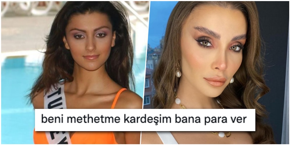 Yüzündeki Değişimlerle Dikkat Çeken Ünlü Model Özge Ulusoy'un Kadınlara Verdiği Estetik Tavsiyesi Olay Oldu!