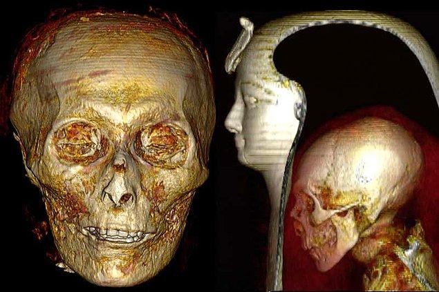 Mumyanın dijital olarak açılmasının ardından I. Amonhotep'in kemik yapısı, öldüğünde 35 yaşında ve 168,5 santimetre boyunda olduğunu gösteriyor.