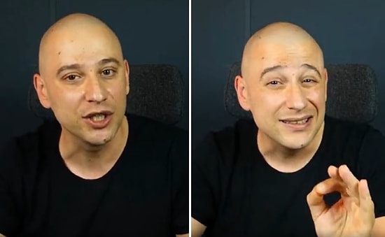 Güçlü Çeneleri ile Bir İnsanı veya Başka Bir Canlıyı Isıran Köpeği Nasıl Engelleyeceğinizi Biliyor musunuz?