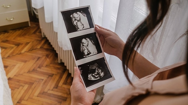 Bir fetüs beslenmesini, hem bebekten hem de anneden gelen hücreleri içeren özel bir organ olan plasentadaki kan damarları yoluyla alır.