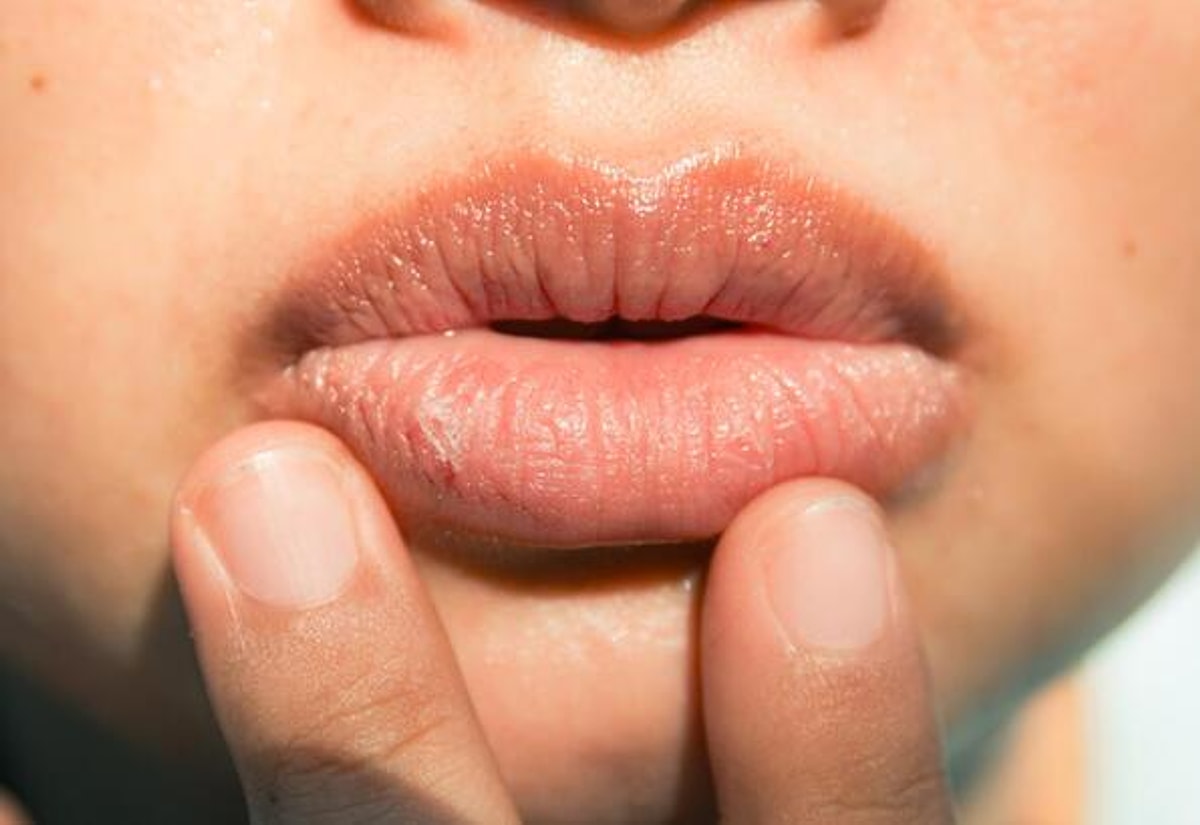 Dudak Morarmasına Hangi Bölüm/Doktor Bakar?