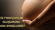 Gebelikte Çatlak Oluşumunu Azaltan En İyi Çatlak Kremleri
