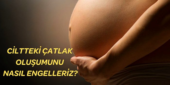 Gebelikte Çatlak Oluşumunu Azaltan En İyi Çatlak Kremleri