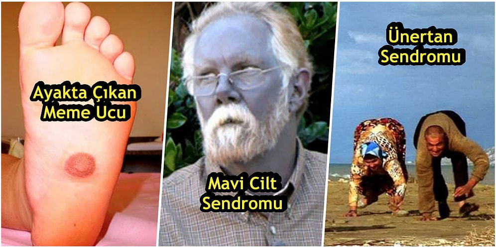 Gerçek Olduklarına İnanmakta Zorlanacağınız 13 Genetik Anomali