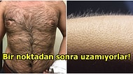 Akıllara Gelen Abuk Soruları Bilim Cevaplıyor: Neden Saç-Sakal Haricindeki Kıllar Belli Bir Yere Kadar Uzar?