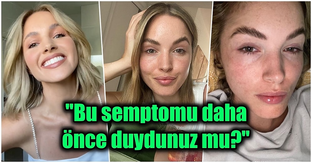 Eski Kainat Güzeli Nadir Görülen Bir Koronavirüs Semptomu Yaşadığını Açıklayarak Herkesi Şaşırttı!