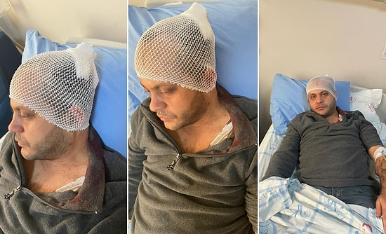 Sağlıkta Şiddet Bitmiyor: Hasta Yakını, Doktora Mermerle Saldırdı!