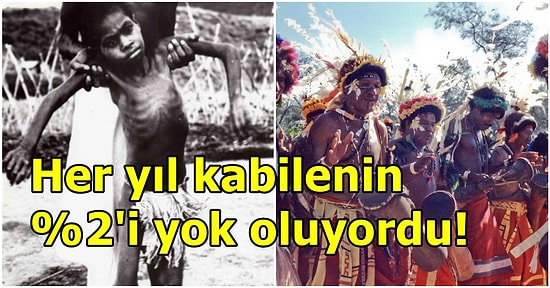 Yamyamlığın Neden Olduğu Ölümcül Beyin Hastalığı Kuru'nun Tarihi ve Gelişimi
