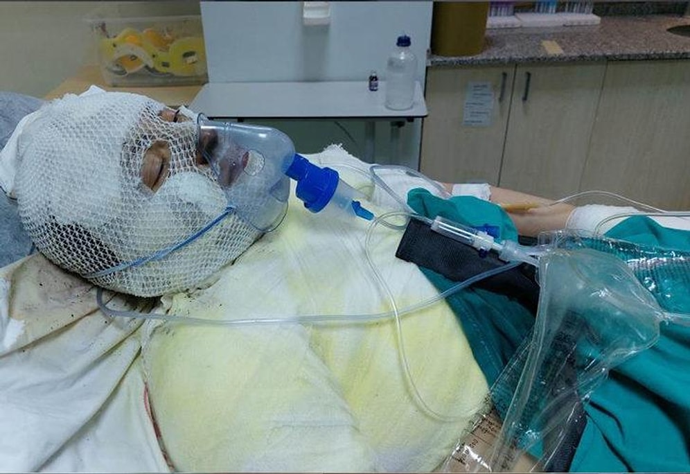 Eski Eşini Yakan Cani Adamın İfadesi: 'Paramı Geri Vermedi'