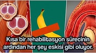 Doktor ve Hastalardan Can Sıkan İddia: Koronavirüse Yakalananların Penisleri mi Küçülüyor?