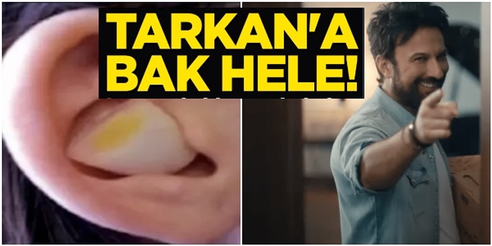 Soğan Sokucuya Bak Hele! Tarkan, Kadınları Taciz Eden Hesapların Hayranı Yeni Akit'i Çok Fena Kudurttu