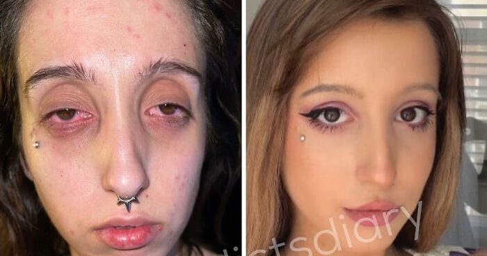 «Дневник наркомана»: 14 новых невероятных историй о том, как люди бросили наркотики