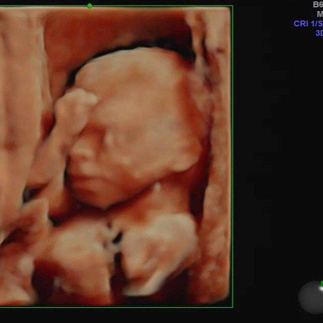 Ve ilk çocuklarının ultrason görüntüsünü de paylaştı.