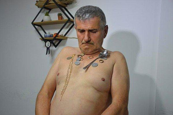 Karasu’da yaşayan 53 yaşındaki Süleyman Demirci’yi görenler gözlerine inanamıyor!