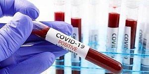 Son Dakika: 21 Ocak Koronavirüs Tablosu Açıklandı! Bugün Koronavirüs Vaka Sayısı ve Vefat Sayısı Kaç Oldu?