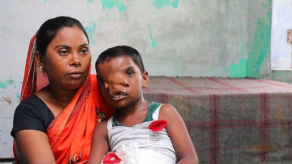 Ailesinin dördüncü çocuğu olan Lakshmi, yıllar içerisinde geçirdiği bazı ameliyat ve prosedürlerin ardından sağlına kavuşmayı başardı.