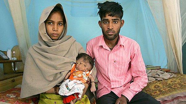 Yine Hindistan'da geçtiğimiz aylarda bir bebek, oldukça nadir görülen yüz duplikasyonu nedeniyle kafasında iki suratla dünyaya gelmişti.