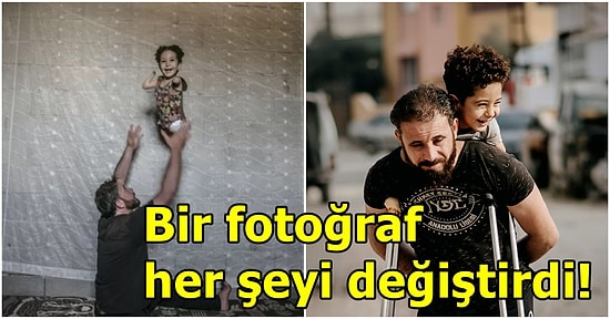 Bir Fotoğraf Hayatlarını Değiştirdi! Suriye'de Yaralanıp Sakat Kalan Baba ve Oğlu İtalya'ya Tedaviye Gidecek