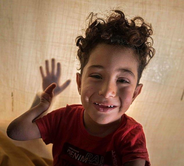 Savaşta kullanılan sinir gazı nedeniyle bu şekilde dünyaya gelen Mustafa ve babası ulusal çapta tanınınca Siena Uluslararası Fotoğraf Ödülleri bir yardım kampanyası başlattı.