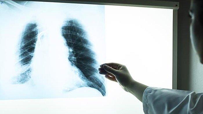 Fransa'da Terör Saldırısında Yaralanan Kadının Doktoru, Çektiği Röntgenin NFT'sini İzinsiz Satışa Çıkardı