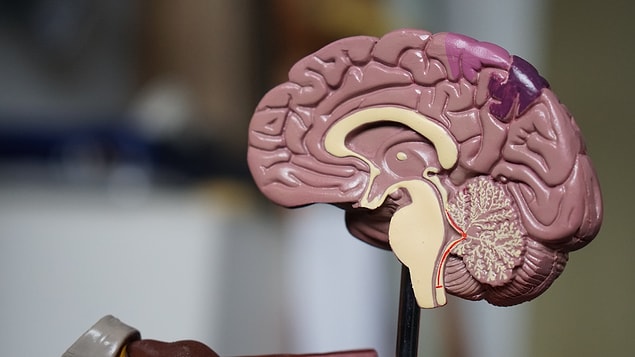 8. Ölümcül bir beyin hastalığı olan prion, enfeksiyonlu eti yiyen insana bulaşır. Her zaman ölümcüldür.