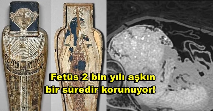 "Gizemli Kadın" Olarak Adlandırılan Bir Mumyanın Doğmamış Çocuğuyla Birlikte Mumyalandığı Ortaya Çıktı!