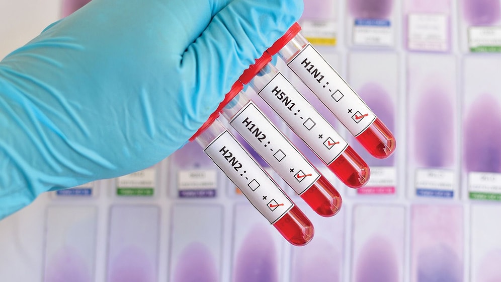 Kuş Gribi Nedir? Belirtileri ve Tedavisi…