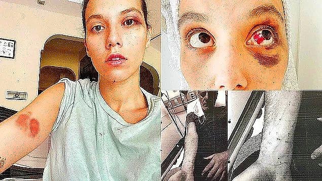 Daha sonra Ozan Güven, Deniz Bulutsuz'a şiddet uyguladığı iddiasıyla gündeme gelmişti. Uzun bir süre bu olayı konuşmuştuk.