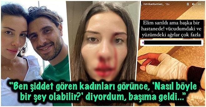 Mihriban Hurmacı Eşi Futbolcu Özer Hurmacı'dan Şiddet Gördüğünü İddia Etti: 'Sen Bir Canavarsın, Boşanacağım!'
