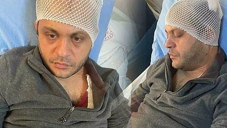 Gaziantep'te Doktora Mermerle Saldıran Hasta Yakını Tutuklandı