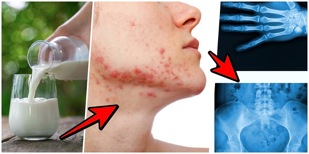 Her Gün Süt İçerseniz Vücudunuzda Ne Gibi Değişiklikler Yaşanır?