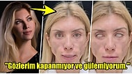 Güzelleşmek İsterken Tanınmaz Hale Gelen Rusya Eski Güzellik Kraliçesi Yulia Tarasevich'in Estetik Faciası