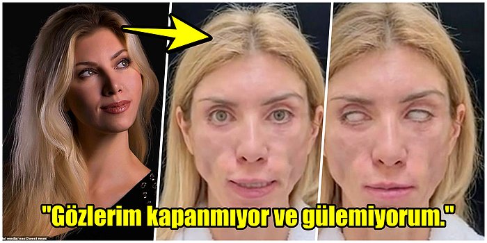 Güzelleşmek İsterken Tanınmaz Hale Gelen Rusya Eski Güzellik Kraliçesi Yulia Tarasevich'in Estetik Faciası