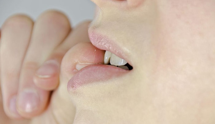 Çocuğun Tırnak Yemesi Nasıl Önlenir? Tırnak Yeme Alışkanlığı Nasıl Bırakılır?