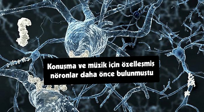 Beyindeki Şarkı Nöronlarının Varlığı Bilim İnsanları Tarafından Yapılan Araştırmayla İlk Kez Tespit Edildi!