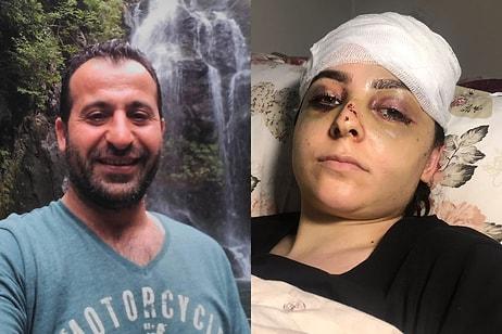 'Tayt Giydi' Diye Karısını Öldüresiye Dövdü: Gözaltına Alındıktan Sonra Serbest Bırakıldı
