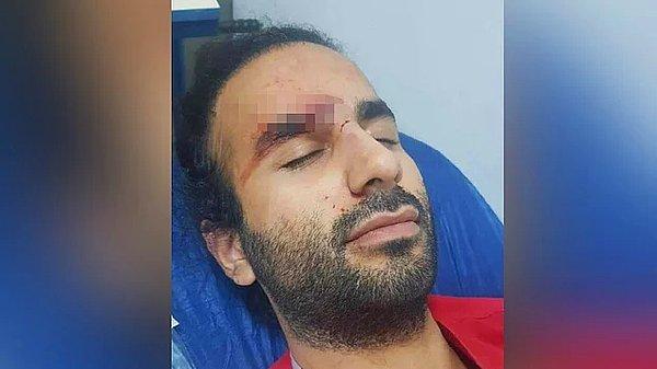 18. 20 Aralık 2021 - Aydın'ın Didim ilçesinde acil servisi doktoru Doğancan Kılıç'a kafa atan ve serbest kalan saldırgan kamuoyu baskısıyla yeniden gözaltına alındı.